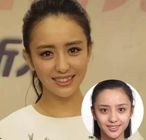 女明星网红整容了吗,整容真相大起底