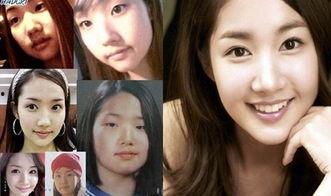 女明星网红整容了吗,整容真相大起底